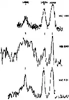 Description de l'image par IA : Graphiques de raies d'émission de galaxies à noyau actif. Raies Hβ et OII visibles, Hβ large, OII plus étroites.