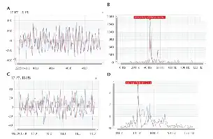 Image description generated by AI: Graphs showing EMG activity and frequency spectra for tonic seizure and normal activity.