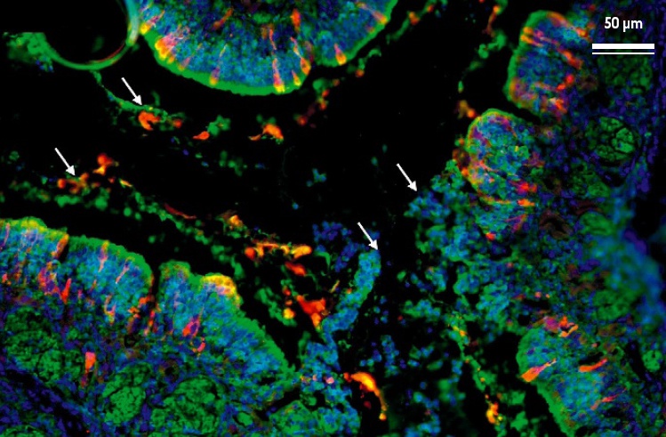 Description de l'image par IA : Cellules colorées, virus rouge, décollage cellulaire, flèches indiquent agrégation.